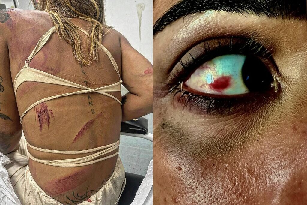 Ariela Nascimento foi covardemente agredida por cinco homens cis (Fotos: Reprodução/Instagram)